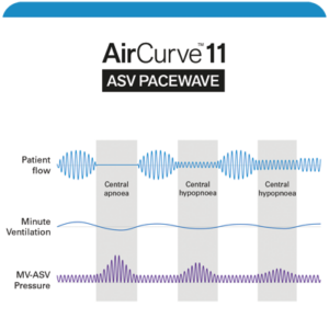 A diagram showing three different air pressure flows of the AirCurve ASV PaceWave algorithm.