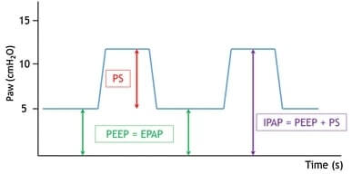 graph showing the difference between PS, PEEP and IPAP